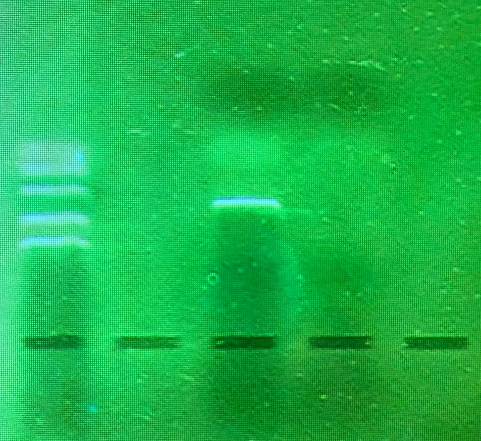 elektrophorese1